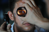 В Новосибирске теперь можно проверить точность тонометров для глаз
